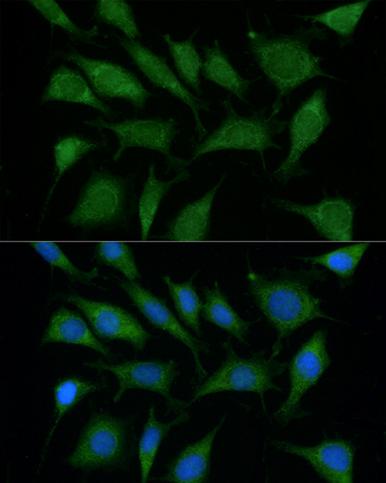 TRIM45 Polyclonal Antibody