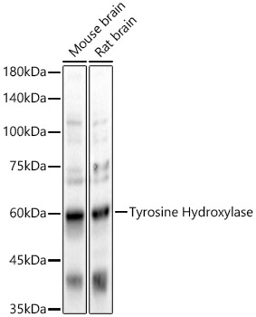 Tyrosine Hydroxylase Polyclonal Antibody