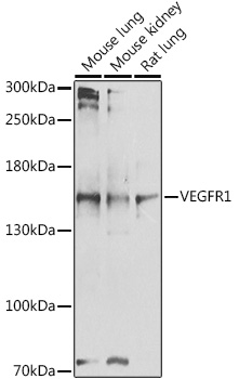 VEGFR1 Polyclonal Antibody