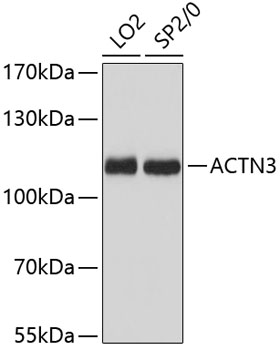 ACTN3 Polyclonal Antibody