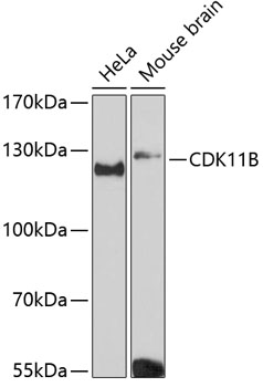 CDK11B Polyclonal Antibody