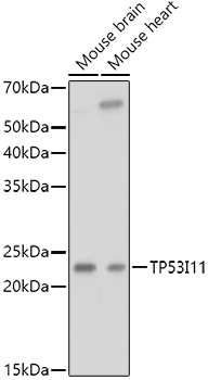 TP53I11 Polyclonal Antibody