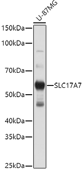 SLC17A7 Polyclonal Antibody