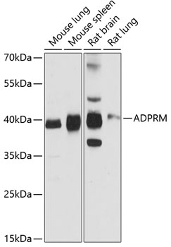 ADPRM Polyclonal Antibody&nbsp;<img src="images/icon_newarrival.gif" alt="new" border="0">