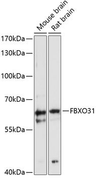 FBXO31 Polyclonal Antibody