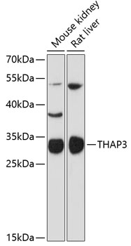 THAP3 Polyclonal Antibody