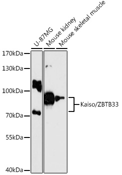Kaiso/ZBTB33 Polyclonal Antibody