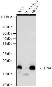 CLDN4 Polyclonal Antibody
