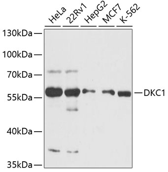 DKC1 Polyclonal Antibody