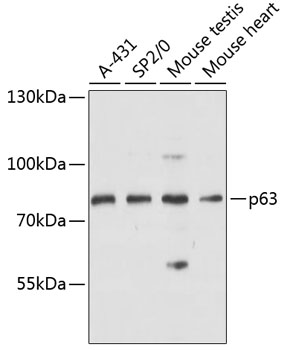 p63 Polyclonal Antibody