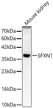 SFXN1 Polyclonal Antibody
