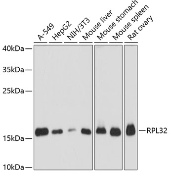 RPL32 Polyclonal Antibody