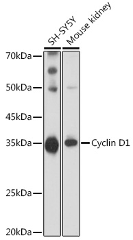 Cyclin D1 Polyclonal Antibody