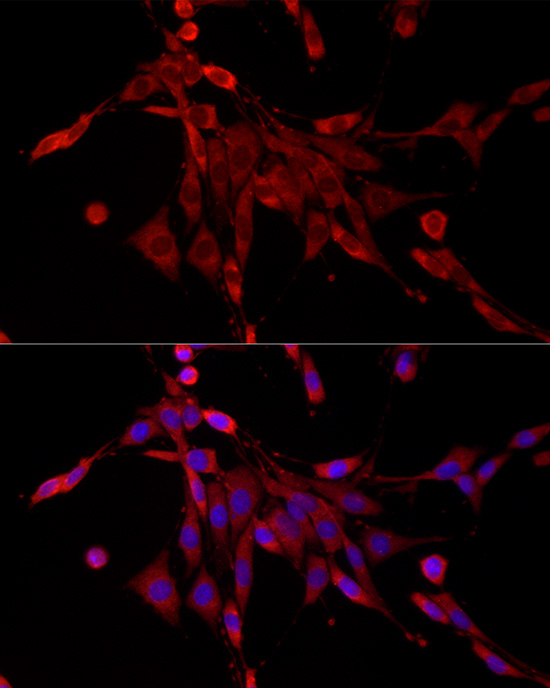 PDE4C Polyclonal Antibody