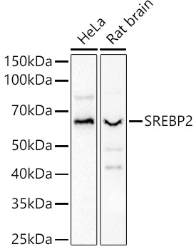 SREBP2 Polyclonal Antibody