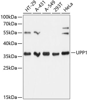 UPP1 Polyclonal Antibody
