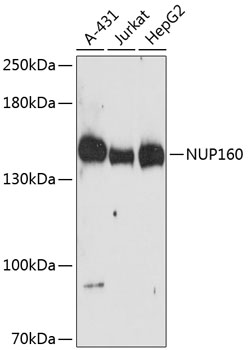 NUP160 Polyclonal Antibody