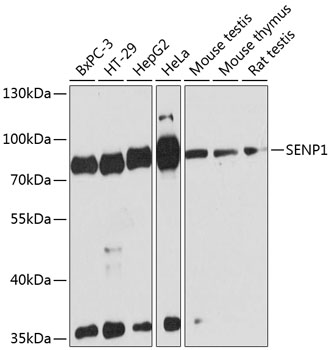 SENP1 Polyclonal Antibody