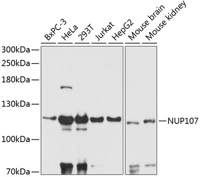 NUP107 Polyclonal Antibody