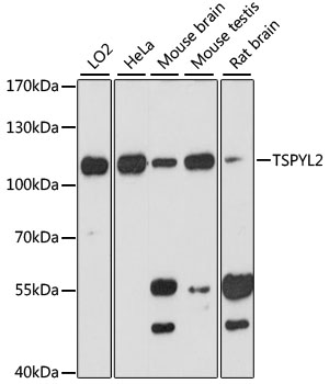 TSPYL2 Polyclonal Antibody