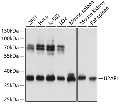 U2AF1 Polyclonal Antibody