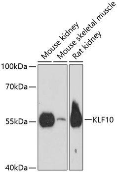 KLF10 Polyclonal Antibody