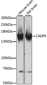 CADPS Polyclonal Antibody