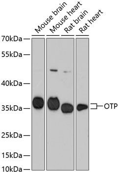 OTP Polyclonal Antibody