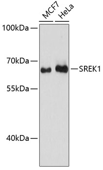 SREK1 Polyclonal Antibody