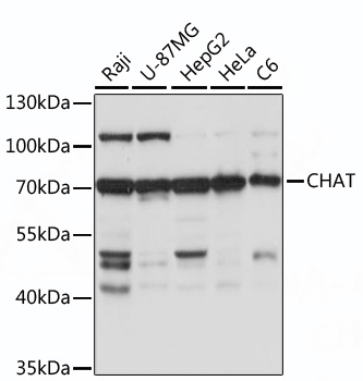 CHAT Polyclonal Antibody