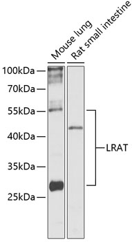 LRAT Polyclonal Antibody