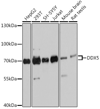 DDX5 Polyclonal Antibody