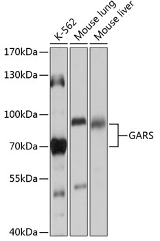 GARS Polyclonal Antibody
