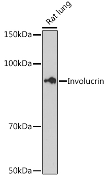 Involucrin Monoclonal Antibody [8H7B3]