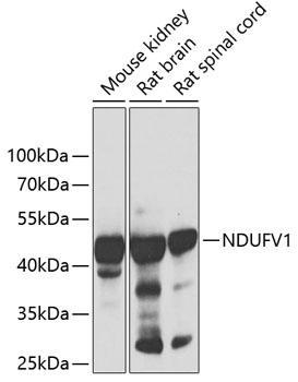 NDUFV1 Polyclonal Antibody