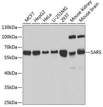 SARS Polyclonal Antibody
