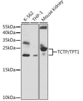 TCTP/TPT1 Polyclonal Antibody
