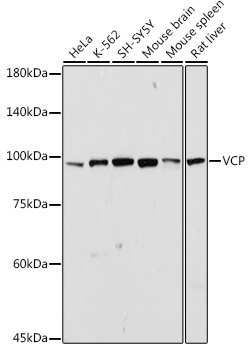 VCP Polyclonal Antibody