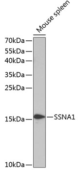 SSNA1 Polyclonal Antibody