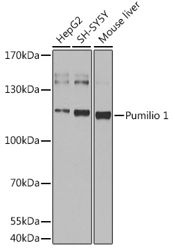 Pumilio 1 Polyclonal Antibody