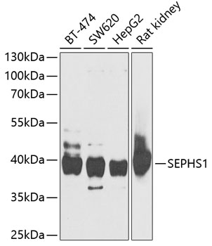 SEPHS1 Polyclonal Antibody