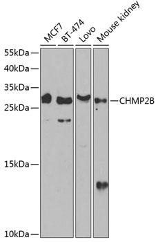 CHMP2B Polyclonal Antibody