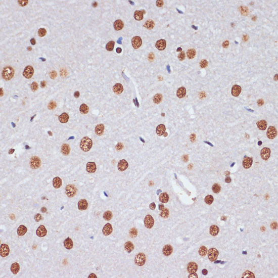 PELP1 Polyclonal Antibody