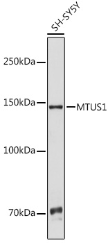MTUS1 Polyclonal Antibody