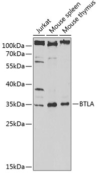BTLA Polyclonal Antibody
