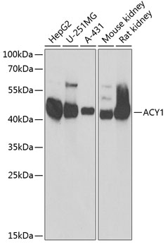 ACY1 Polyclonal Antibody&nbsp;<img src="images/icon_newarrival.gif" alt="new" border="0">