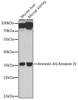 Annexin A4/Annexin IV Polyclonal Antibody