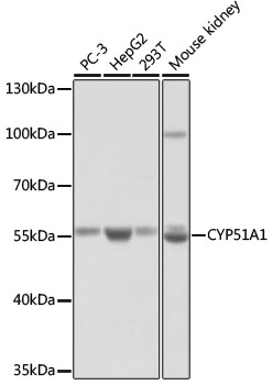 CYP51A1 Polyclonal Antibody
