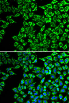 LIPC Polyclonal Antibody
