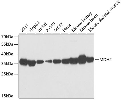 MDH2 Polyclonal Antibody